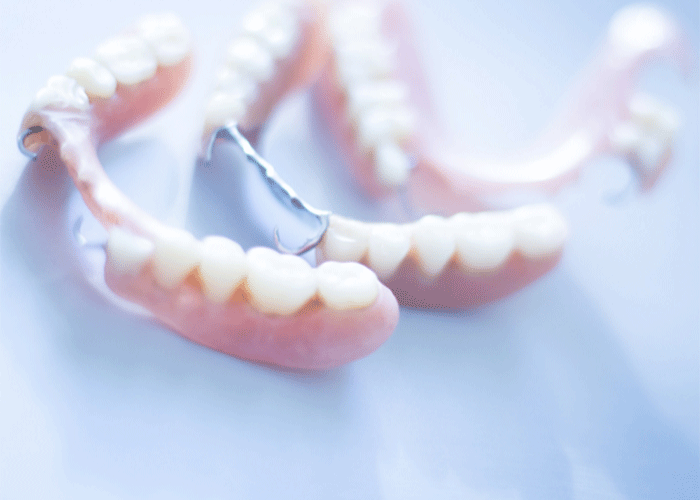 three different types of partial dentures